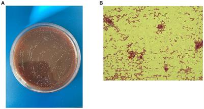 Christensenella minuta, a new candidate next-generation probiotic: current evidence and future trajectories